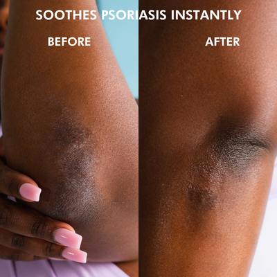 AFRICAN BEAUTY BUTTER - Intensive Dry Skin Treatment